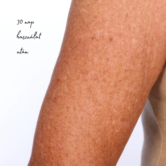 Kép 4/5 - U Beauty The Sculpt Formáló és tonizáló testkezelés karra
